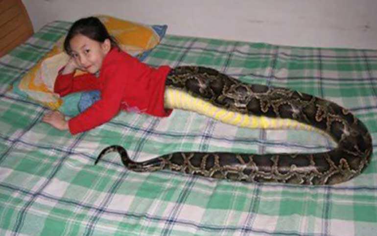 Jedni tvrde da ima bolest Jing Jing, drugi da je u pitanju prevara: Devojčica u telu zmije – umesto nogu ima zmijsku krljušt, a ljudski torzo